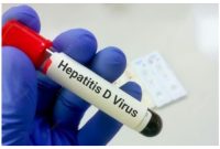 Penyakit Hepatitis Akut tengah ramai diperbincangkan karena menyerang anak-anak di beberapa negara. (freepik)