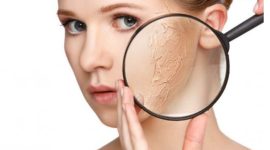 Ilustrasi kulit kering (suara.com)