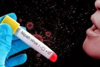 Gejala, Penularan dan Pencegahannya
Virus Nipah (Shutterstock) -