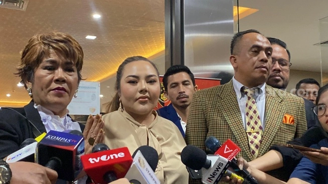Lisa Mariana dipanggil KPK hari ini (sumber: suara.com)