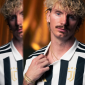 Juventus Resmi Pinjam Nick Woltemade dari Newcastle, Jadi Amunisi Baru Lini Depan. Instagram @juventus